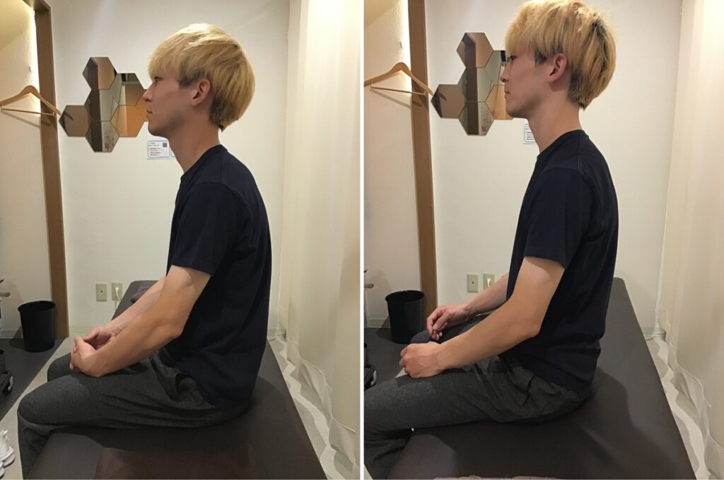 左から見た姿勢の変化 ビフォーアフターを左から見た写真