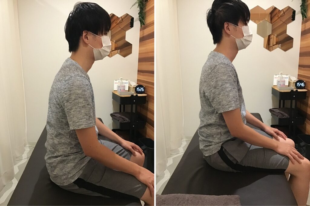 姿勢の変化を示した写真 施術前後の変化
