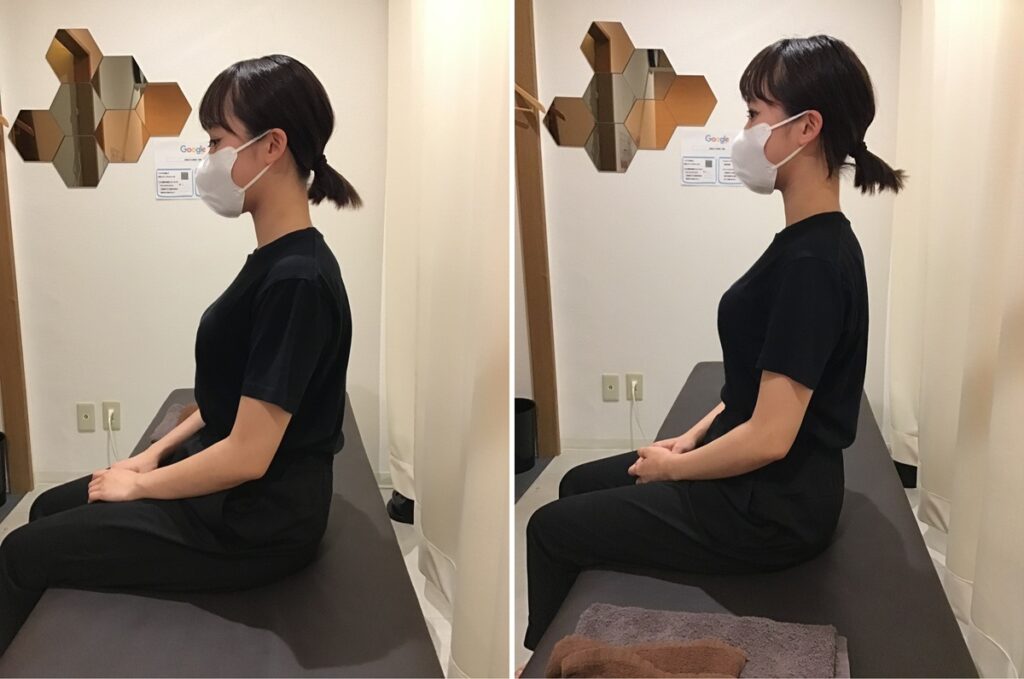 肩こりに対する施術の前後の写真 肩こり初回施術の前後