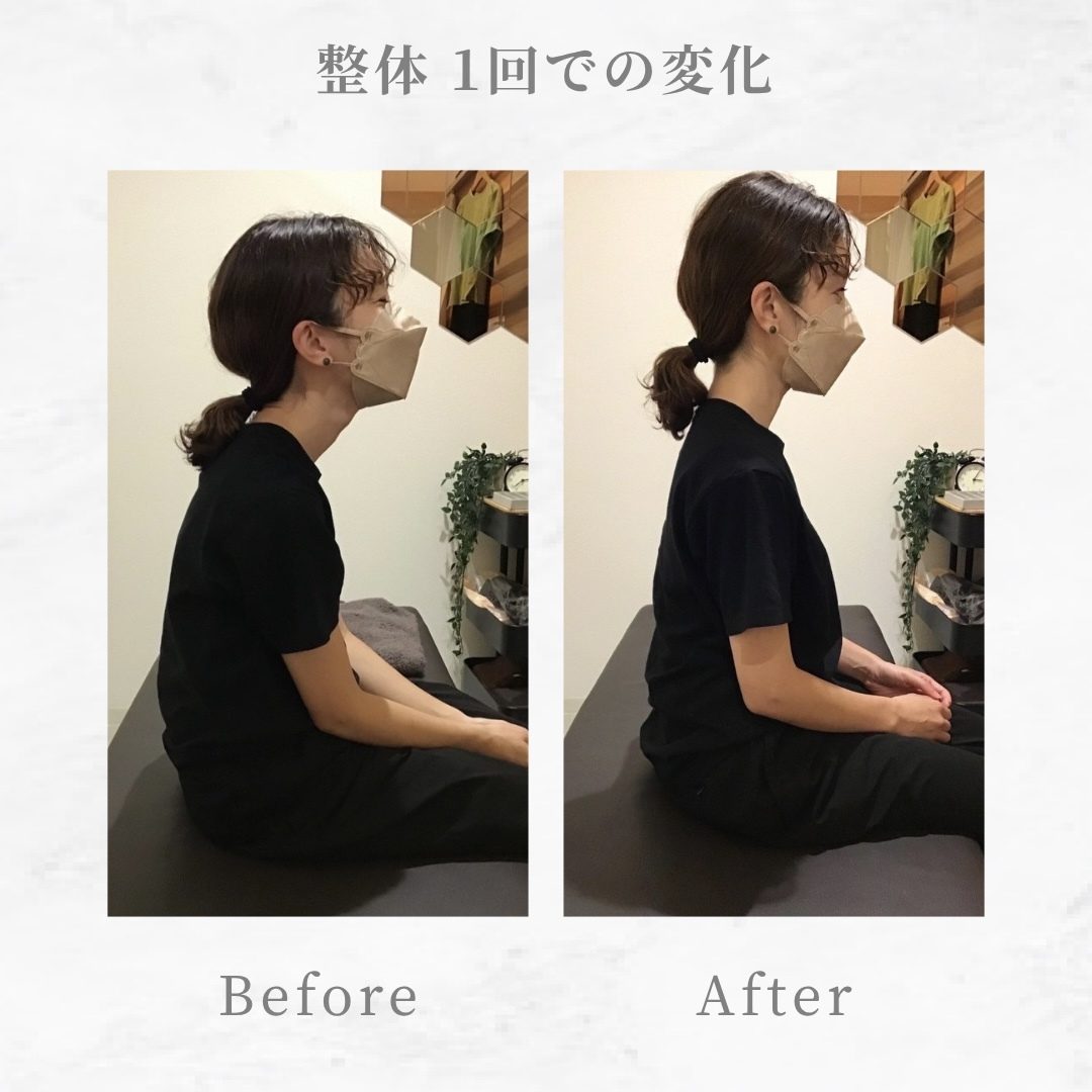 施術前後の姿勢の比較 施術前後の姿勢の変化